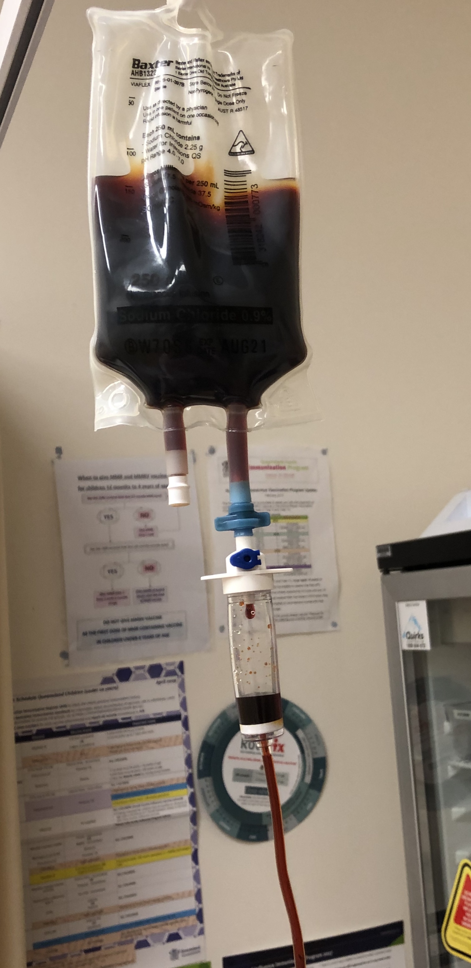 Iron infusion at Mudgeeraba Family Medical Centre